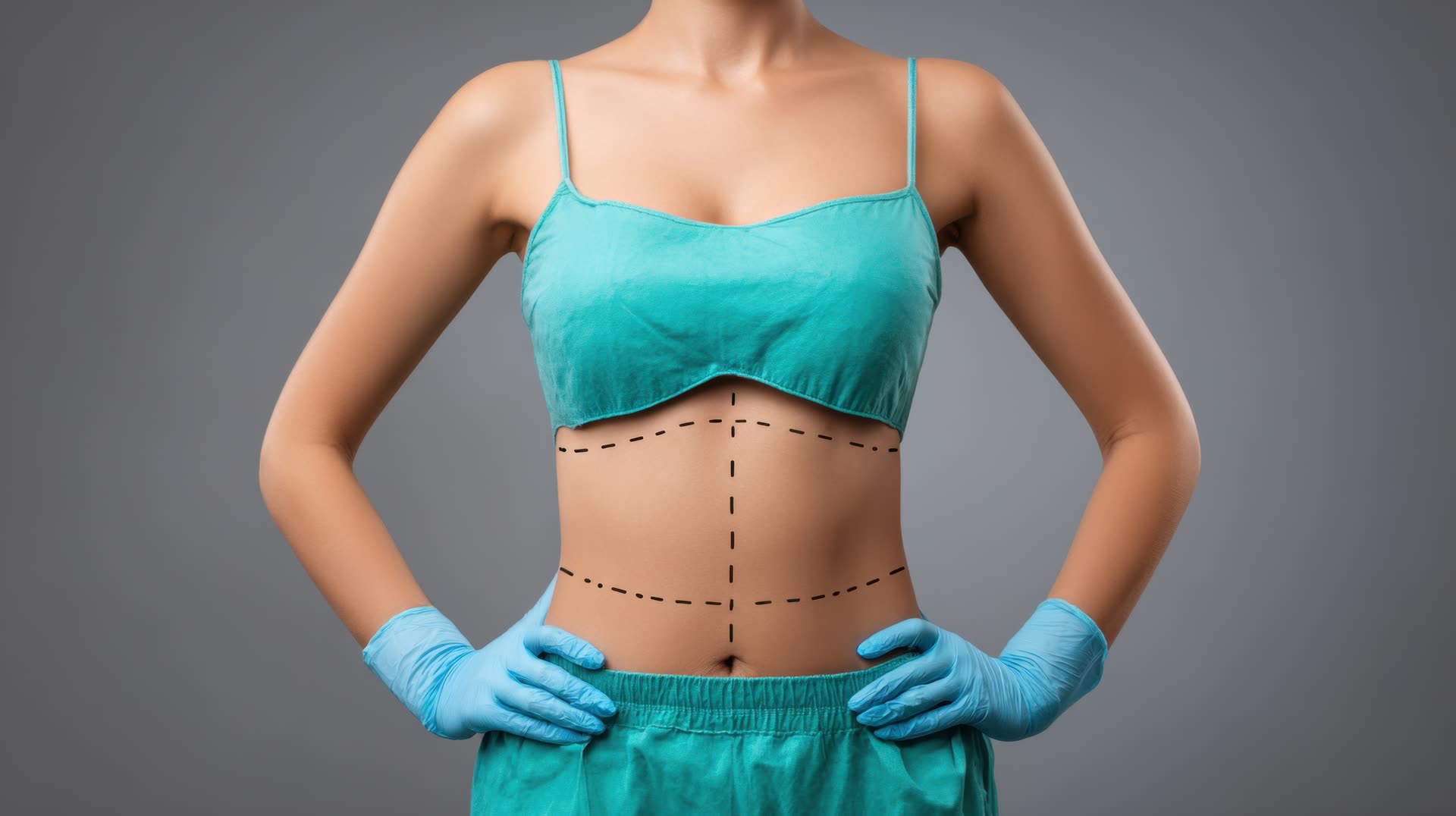 Body Contouring Surgery