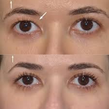 Gallery 1