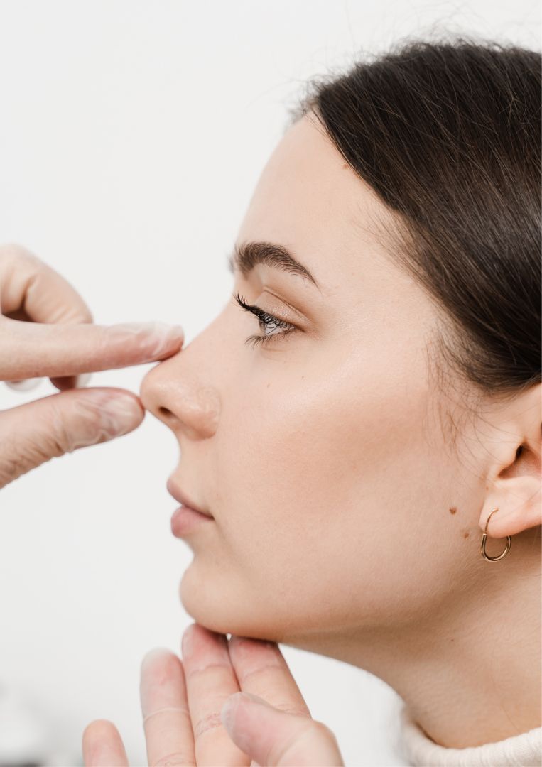 Rhinoplastie Secondaire