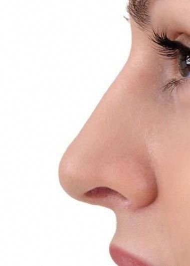 Rhinoplastie Fonctionnelle