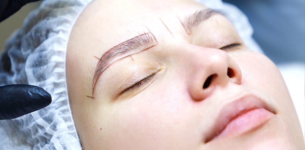 Greffe de Sourcils